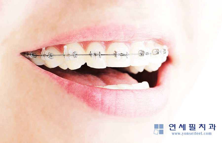 연세필치과교정과 이미지