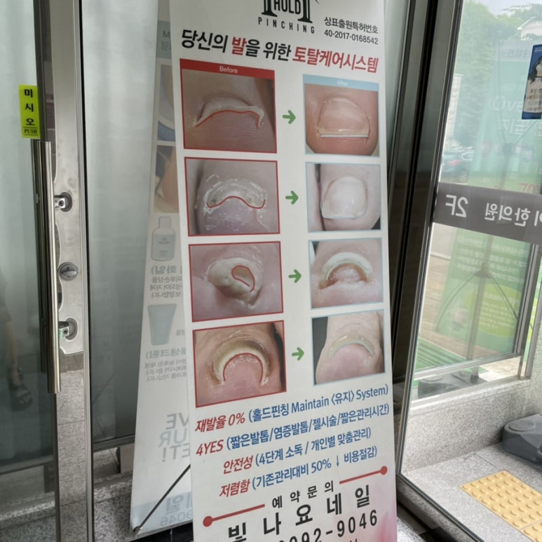 빛나요네일 이미지