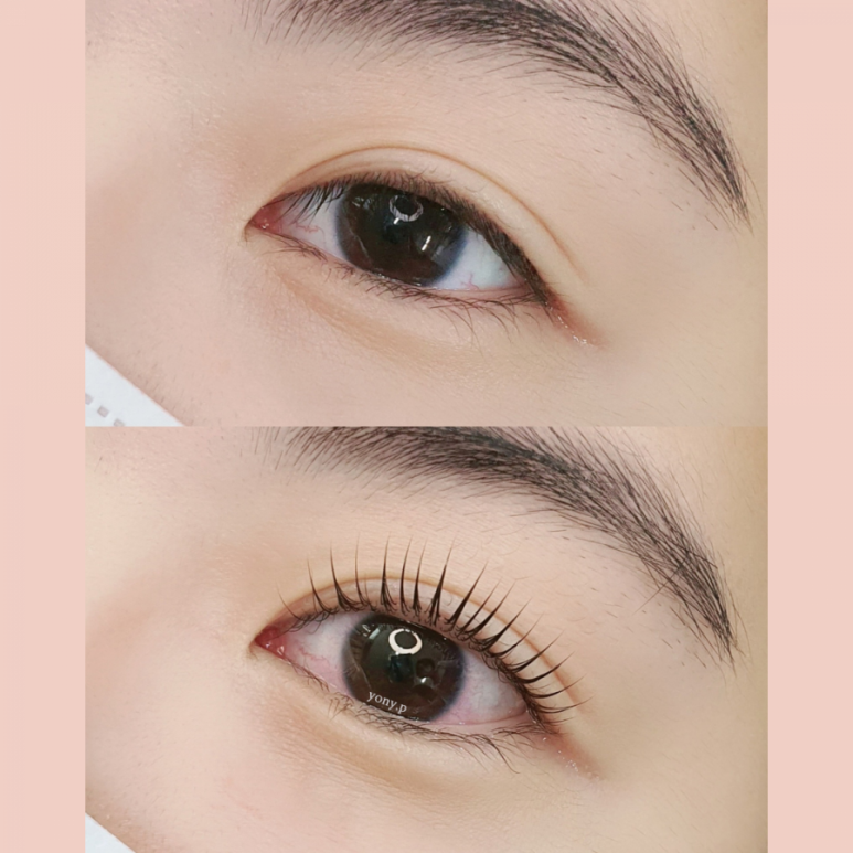 요니뷰티 이미지