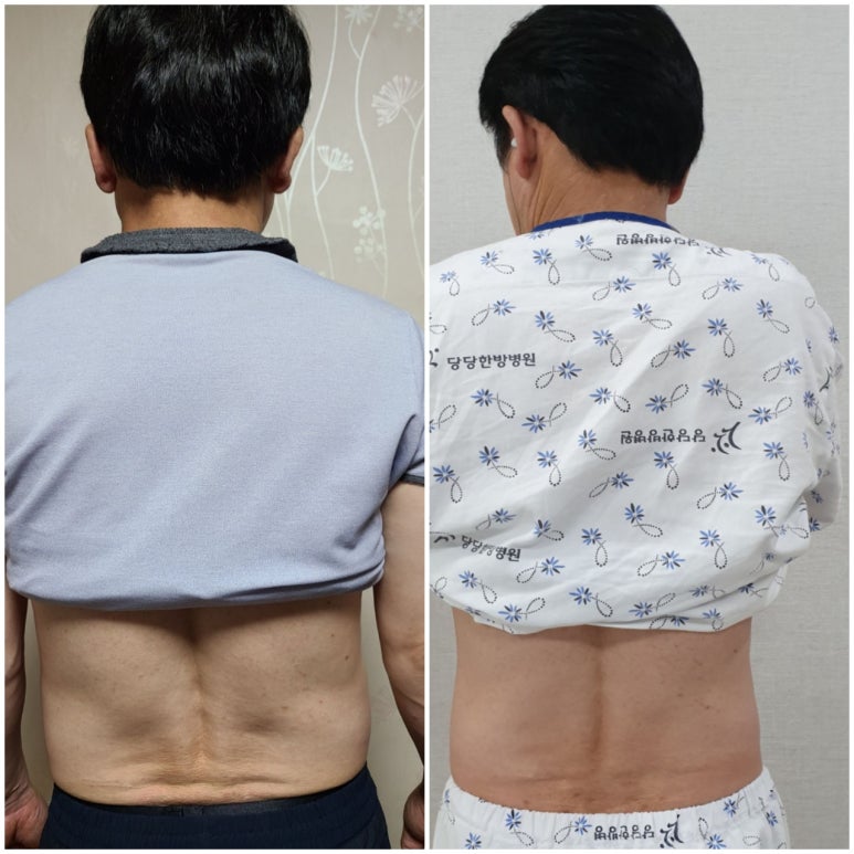 힐링크린 이미지