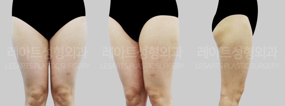 아트라인성형외과의원 이미지