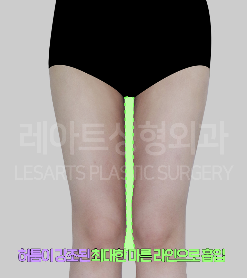 아트라인성형외과의원 이미지