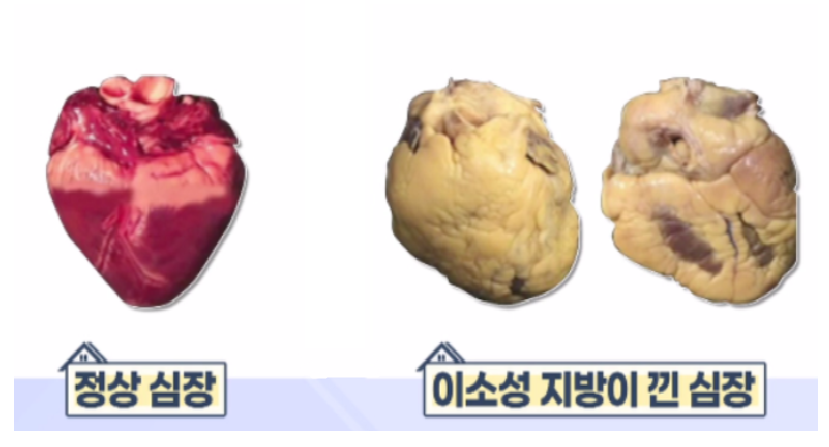 초월헬스 이미지