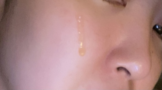 피부본연 이미지