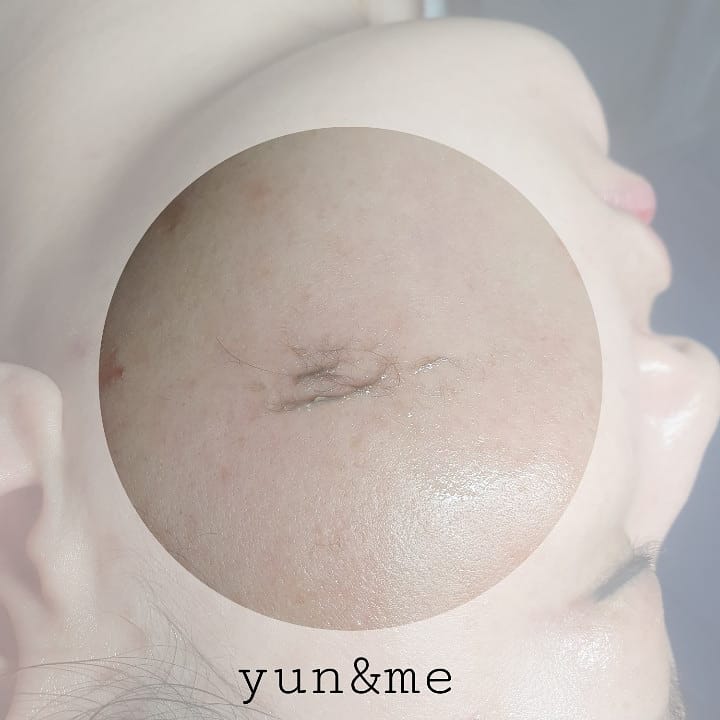 윤피부토탈관리 이미지