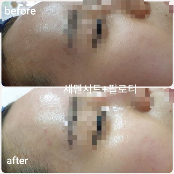 강명화스킨케어 이미지