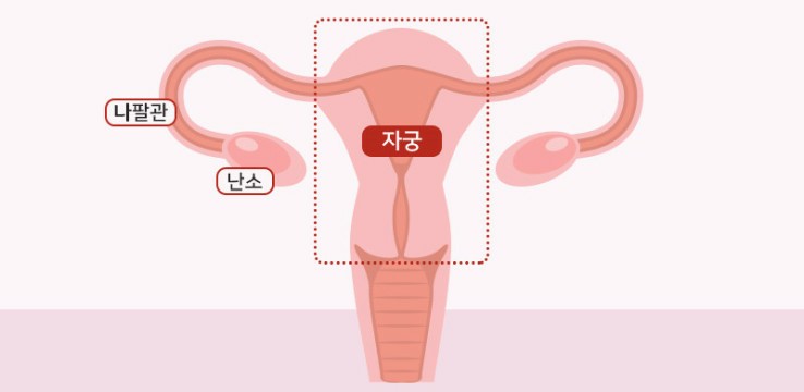 힐링궁 이미지