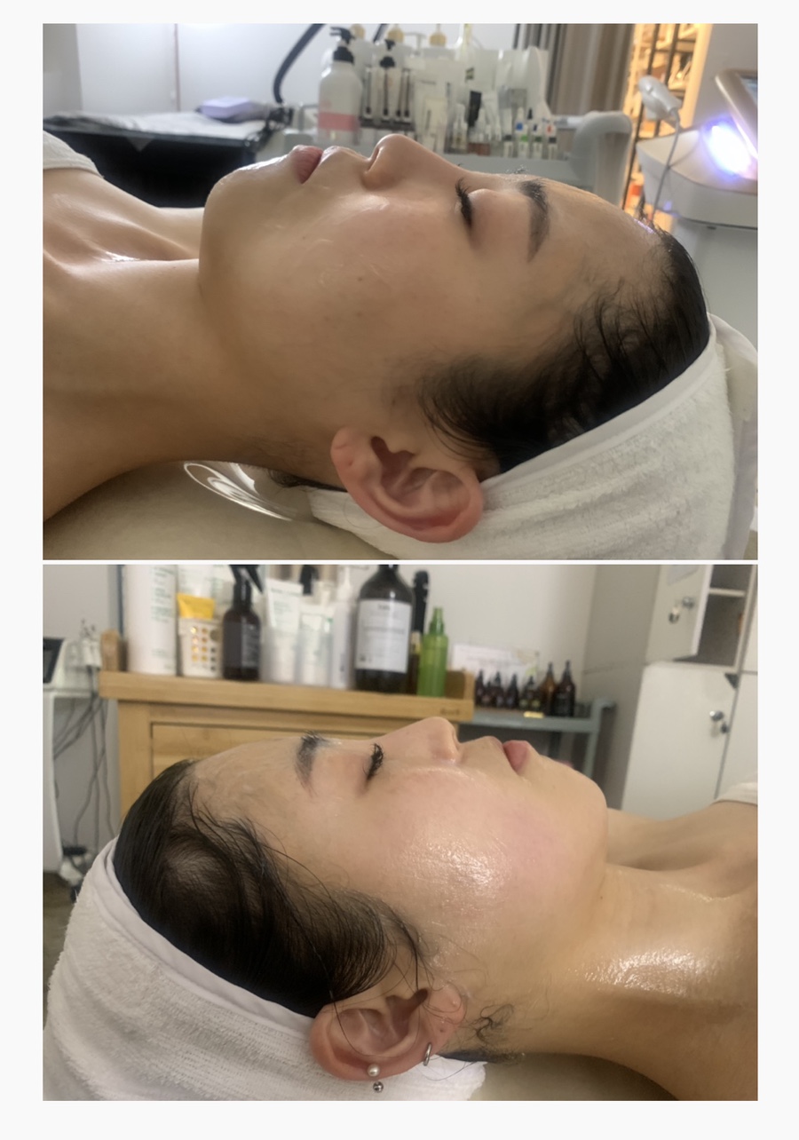 제니스킨앤바디 이미지