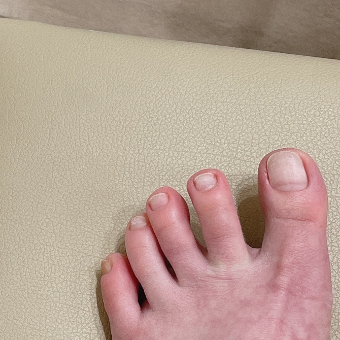 오프트네일 이미지
