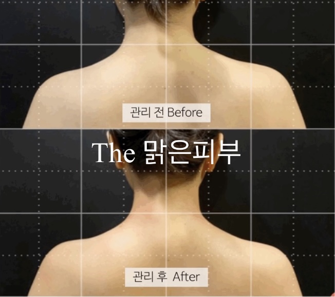 The 예쁜 피부 이미지