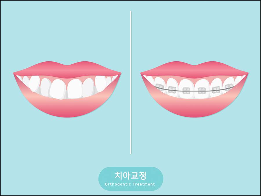 클린피씨 이미지