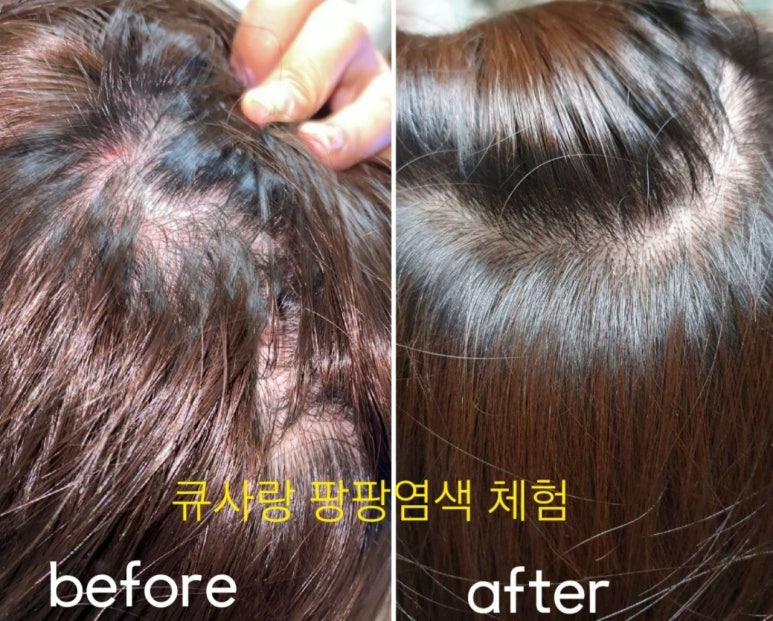 큐사랑염색방영동 이미지