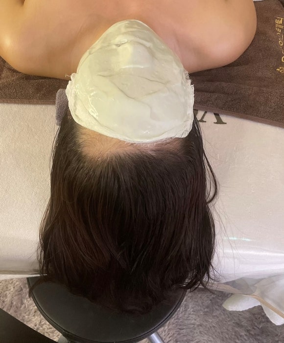 마쏘스킨바디 이미지