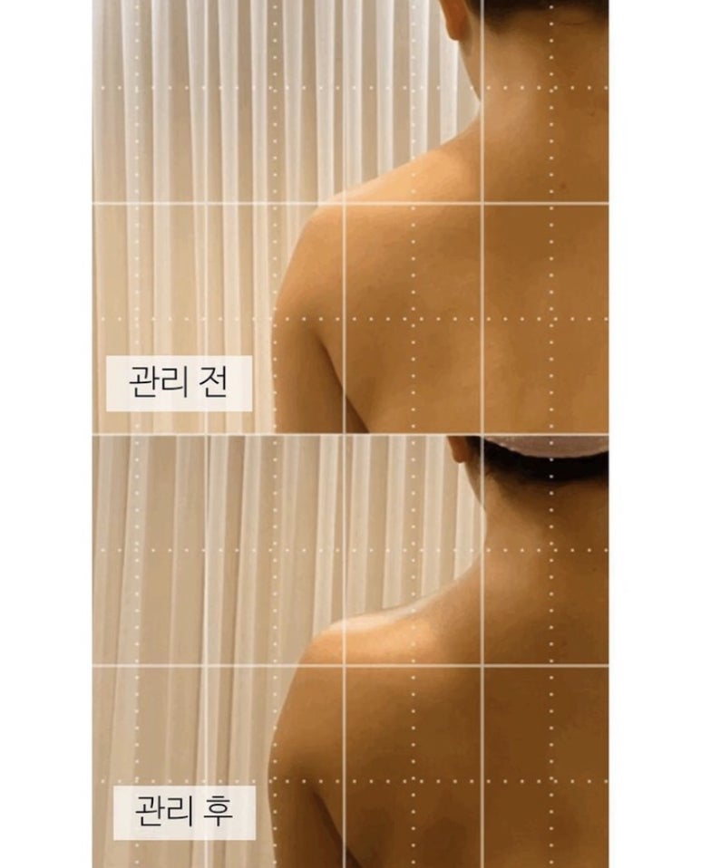 The 예쁜 피부 이미지