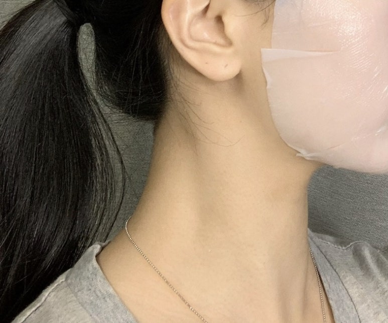 알엔에스 이미지