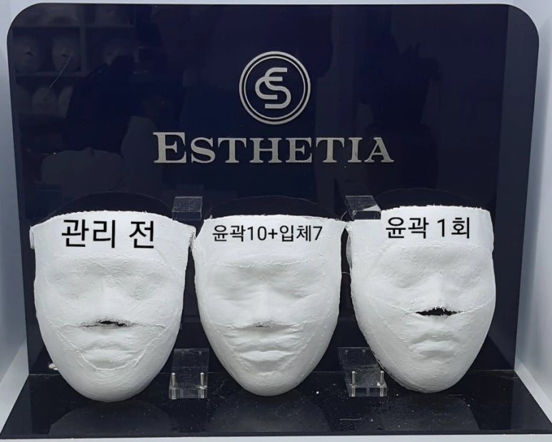 에스테티아세종소담 이미지