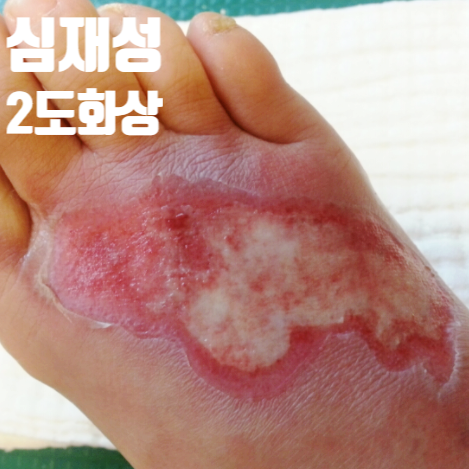 심재성 이미지