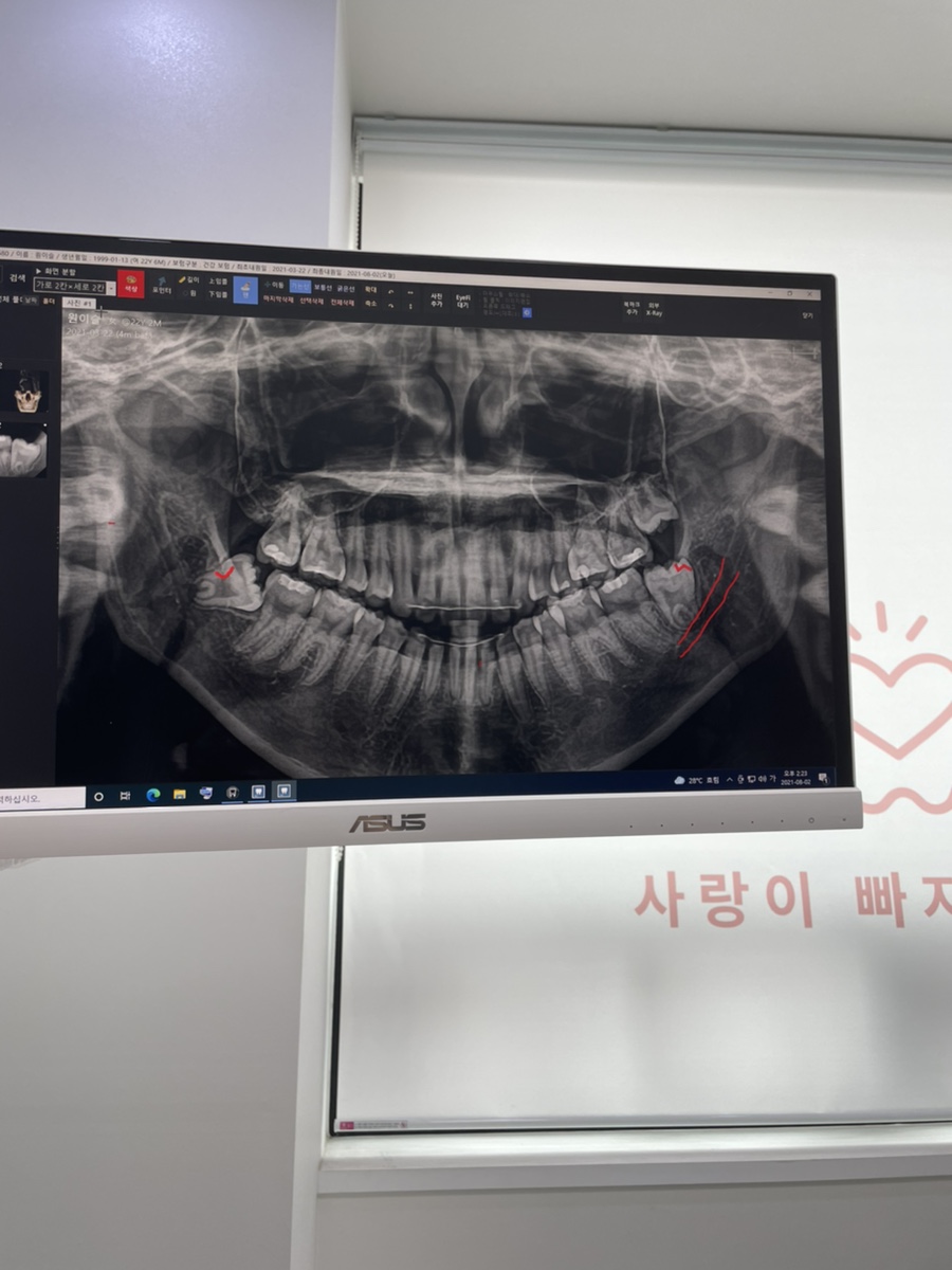 사랑니빠지는구강악안면외과치과의원 이미지