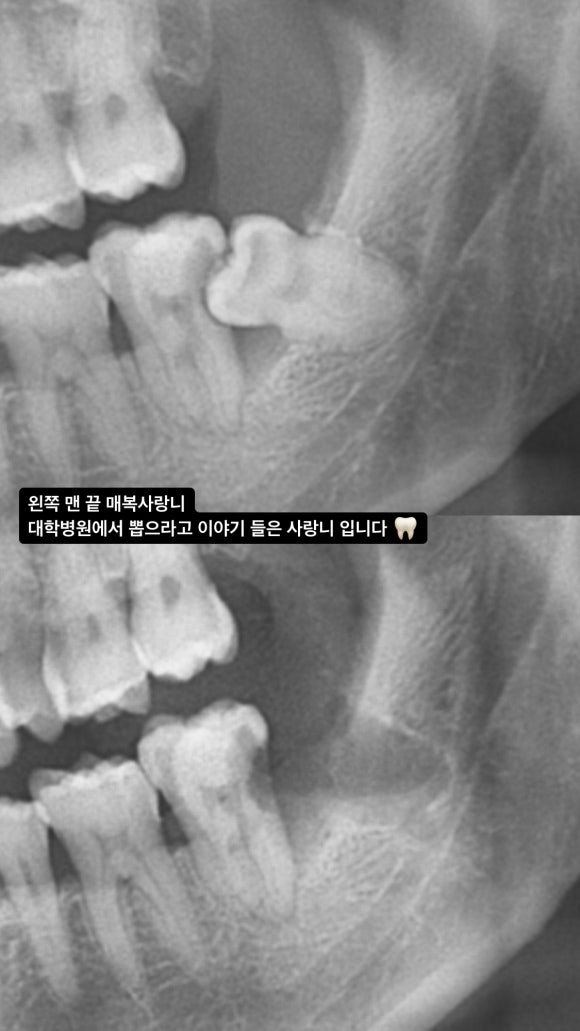 서울예인치과 이미지