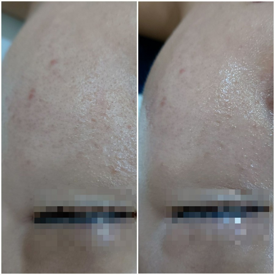 채움에스테틱 이미지