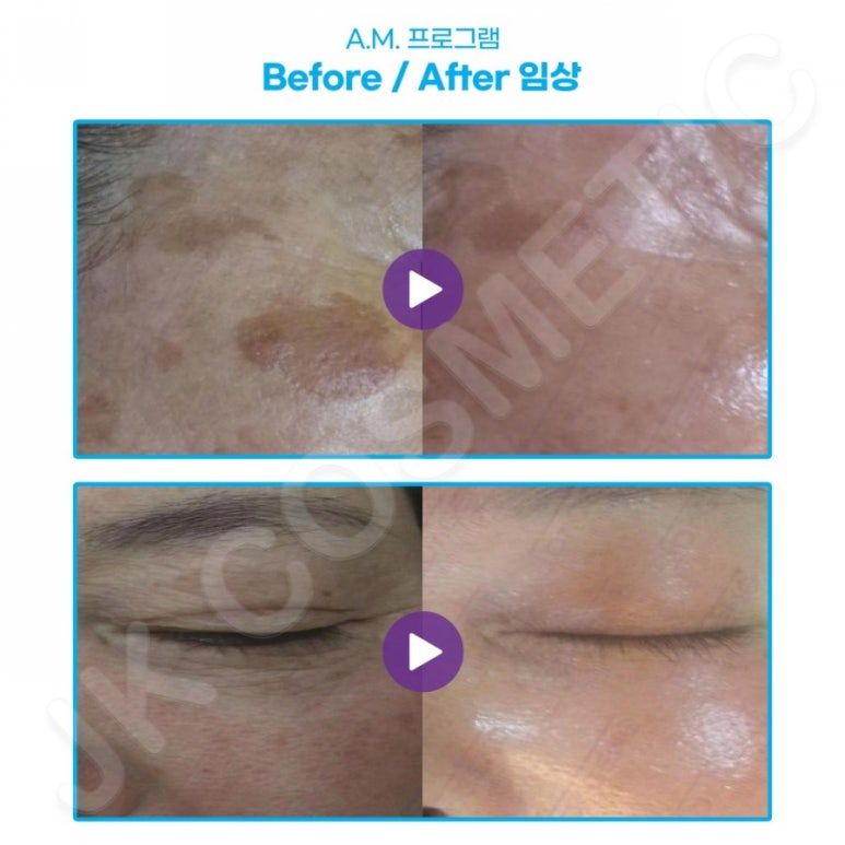 제노시스템 이미지