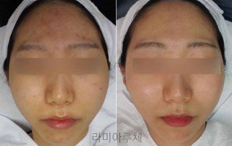 라미아루체 이미지