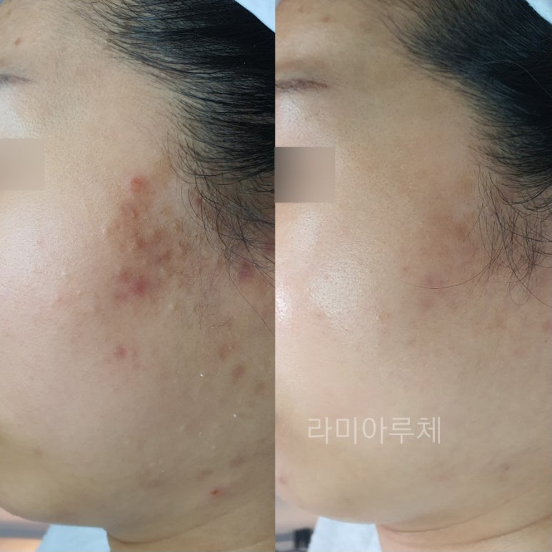 라미아루체 이미지