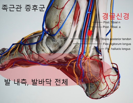 휴식공간운동요법 이미지