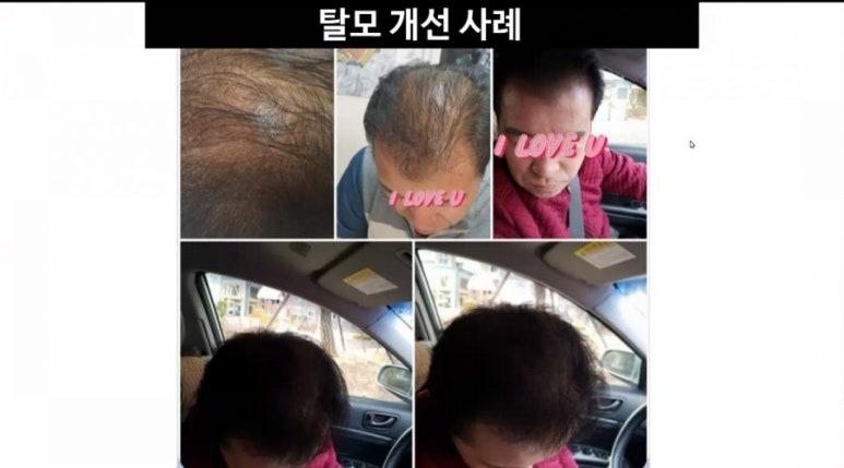 진크린 이미지