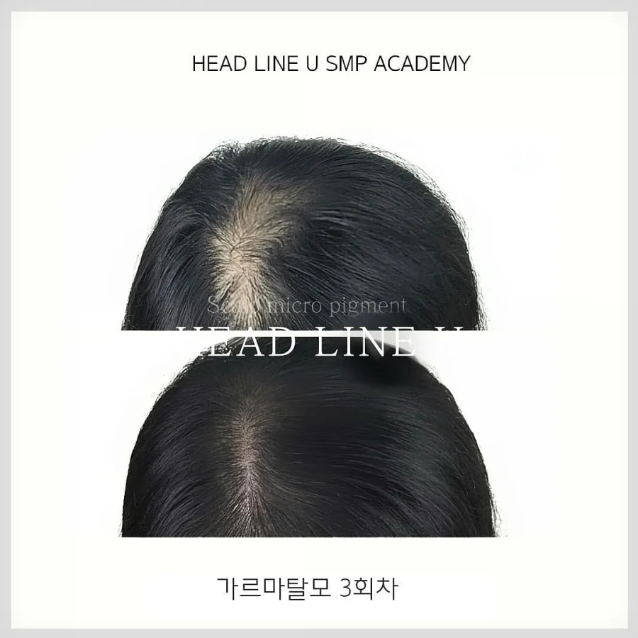 헤드라인유 이미지