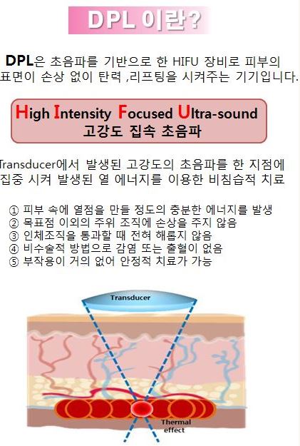 디피엘 이미지