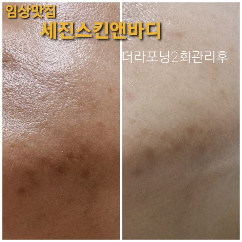 승천바디케어 이미지