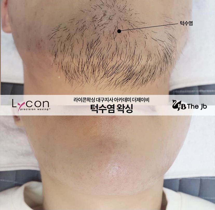 제이비라인 이미지