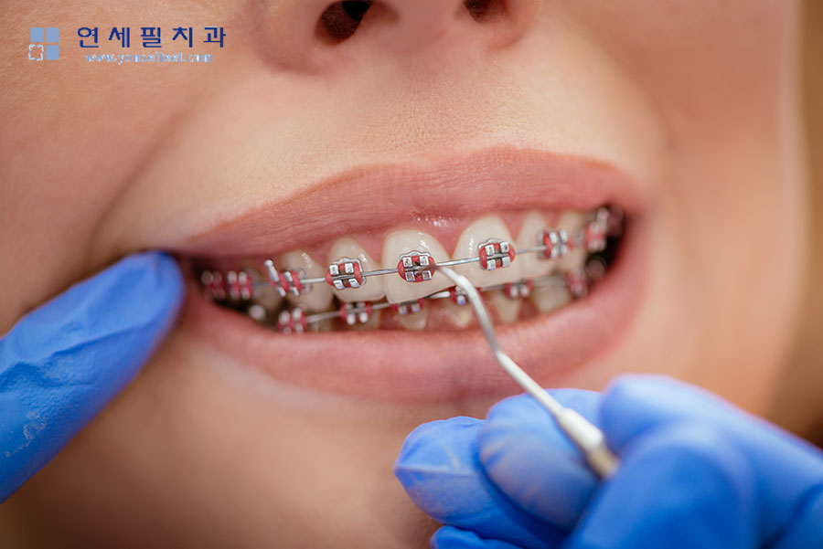 연세필치과교정과 이미지