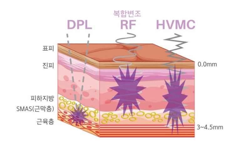 디피엘 이미지