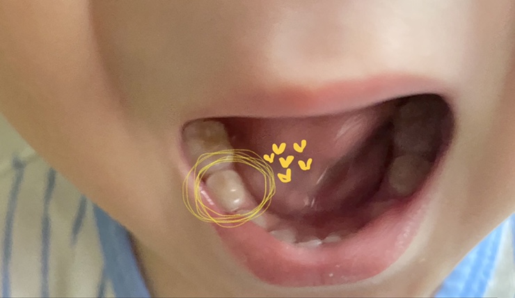 서울더키즈치과의원 이미지