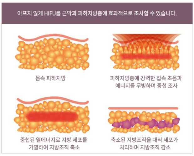 디피엘 이미지