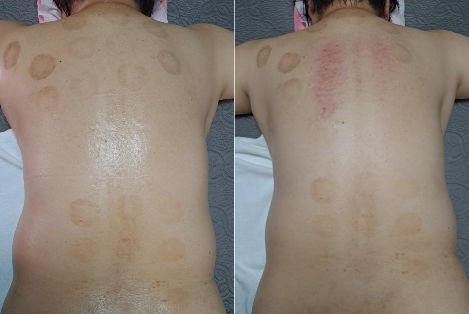 더고은스킨앤바디 이미지