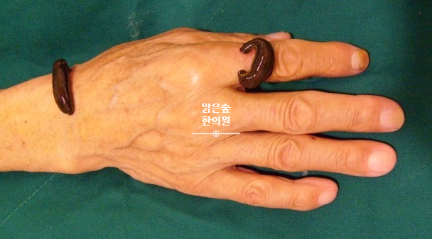 엔한의원 이미지