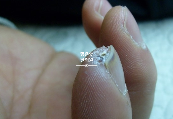 엔한의원 이미지