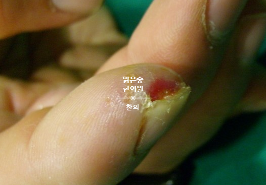 엔한의원 이미지