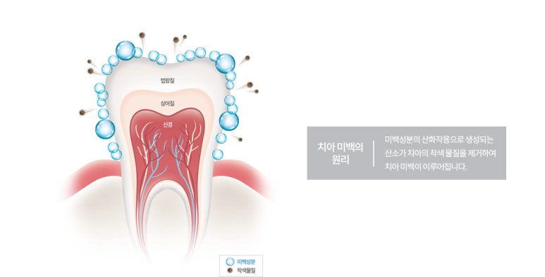 백세치과 이미지