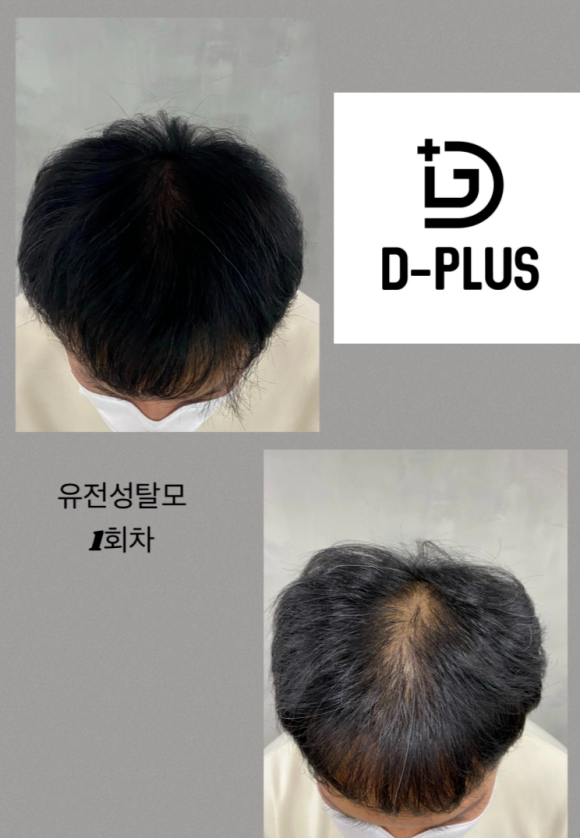 디플러스디자인 이미지