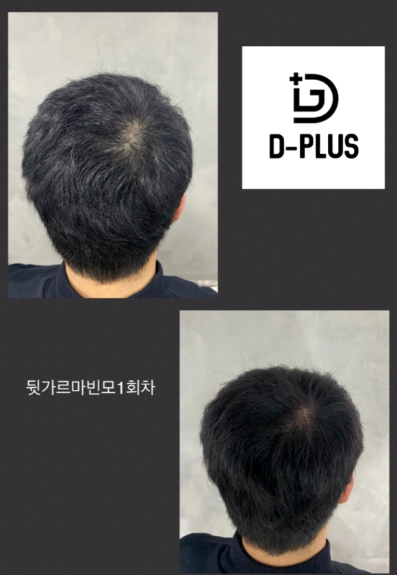 디플러스디자인 이미지
