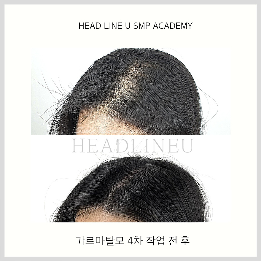 헤드라인유 이미지