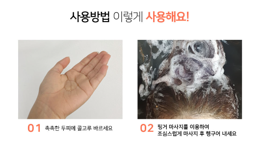 글리제미용재료 이미지