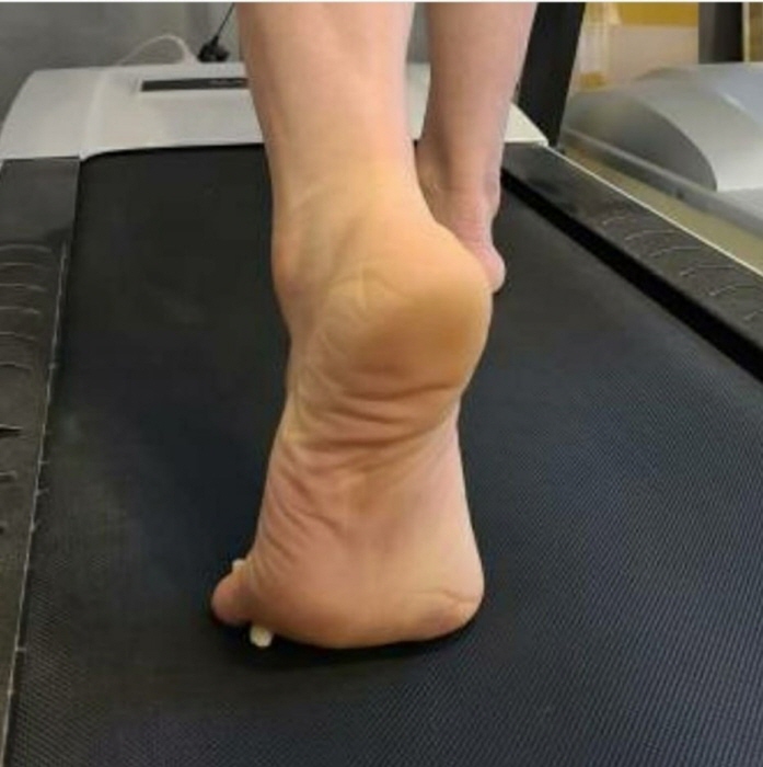 귀족체형관리 이미지