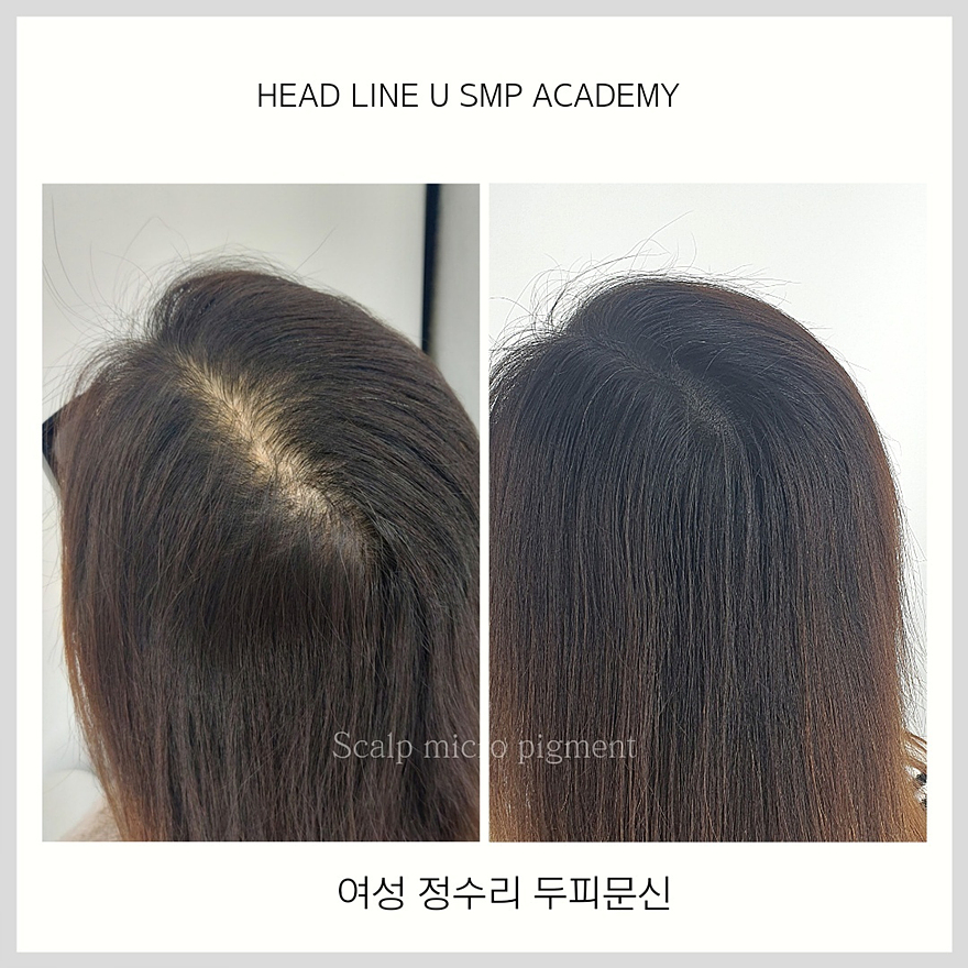 헤드라인유 이미지