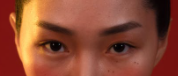 아티스성형외과 이미지