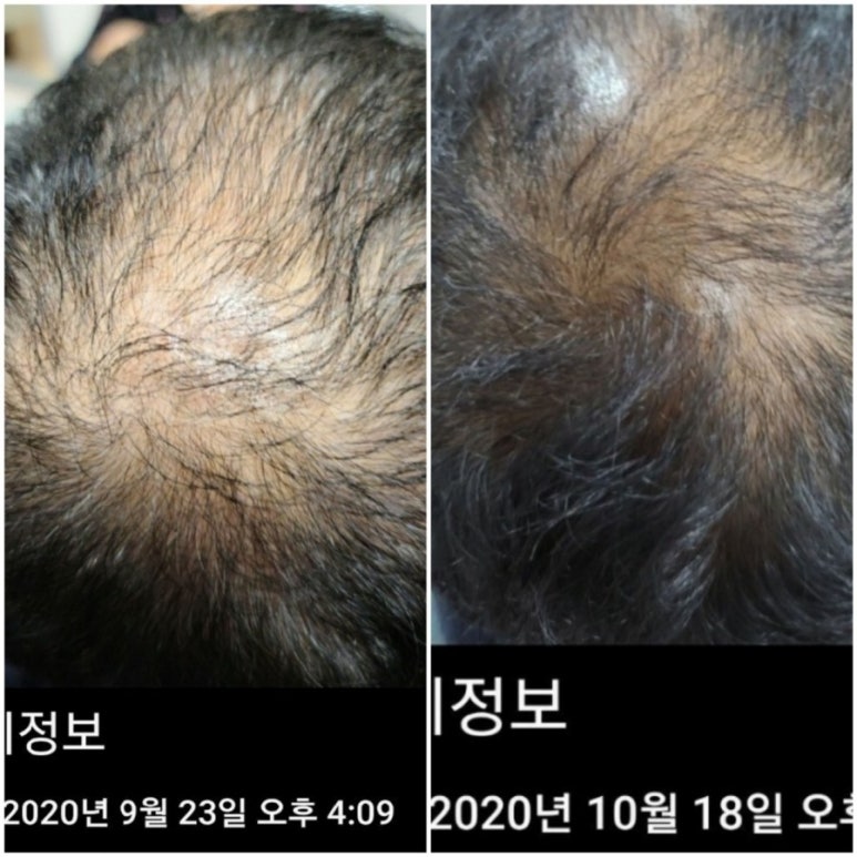방영학 이미지